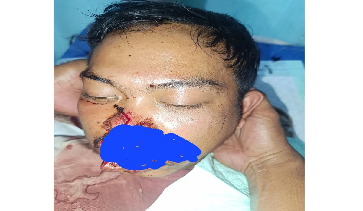 : Warga Gayo Lues Waswaspada Setelah Serangan Harimau di Kebun